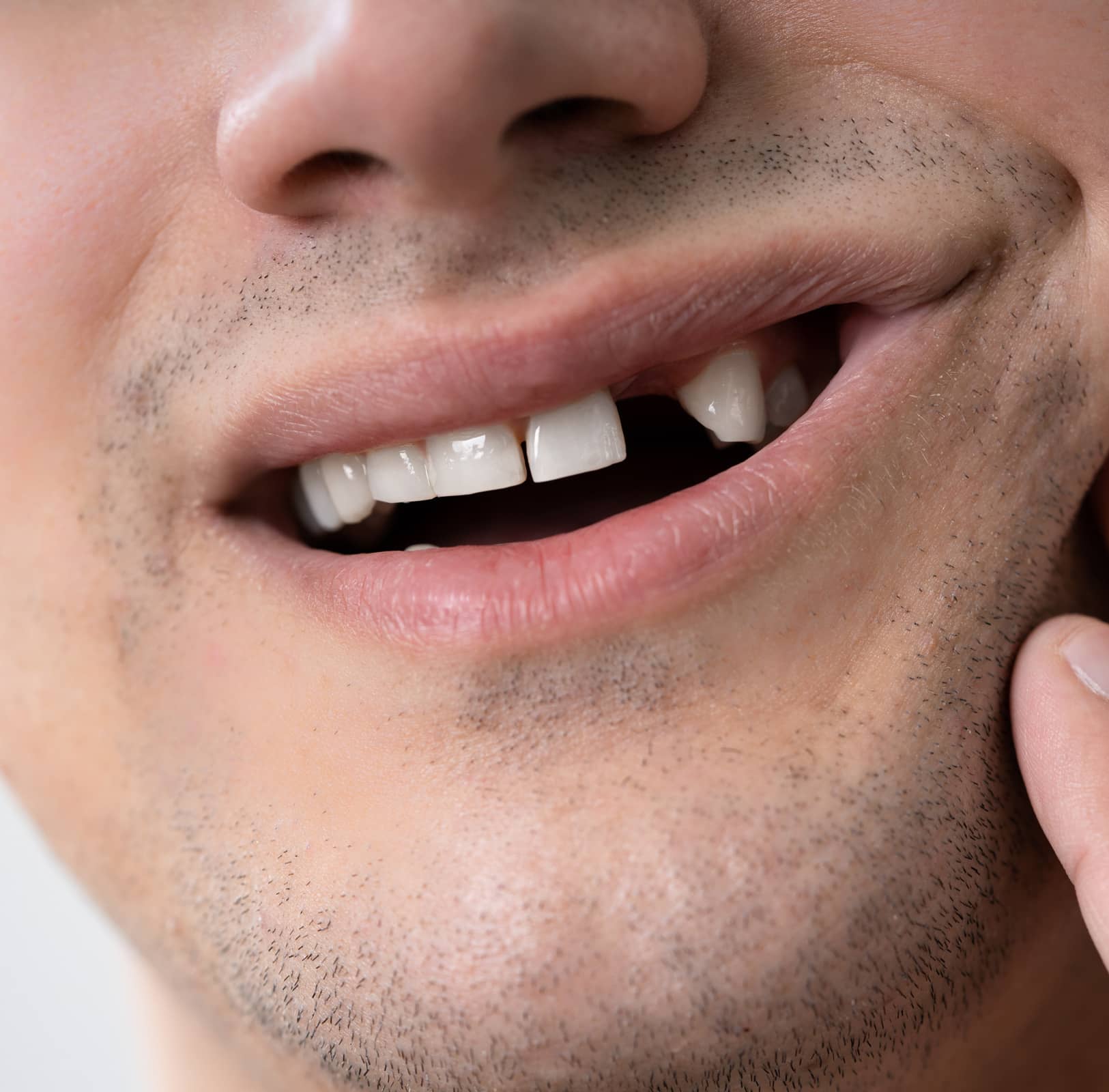 Man Having Toothache